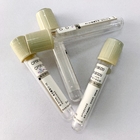 Disposable Glucose Blood Tube Sodium Fluoride Potassium Oxalate Additive